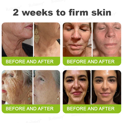 👨‍⚕️Made and shipped from Australia 💫Rolimey® Botox & Vita-A Retinol Shot Wrinkle-Lift Tightening cream - Last Day Promotion 70% OFF