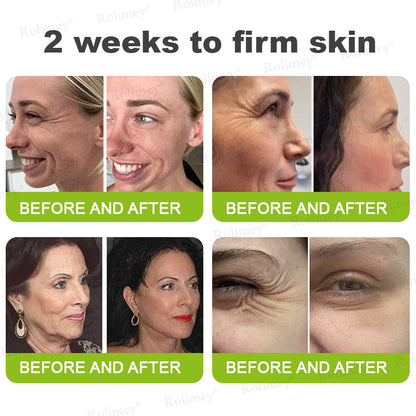 👨‍⚕️Made and shipped from Australia 💫Rolimey® Botox & Vita-A Retinol Shot Wrinkle-Lift Tightening cream - Last Day Promotion 70% OFF