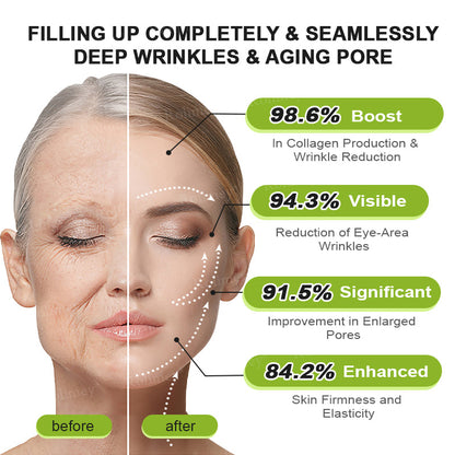 👨‍⚕️Made and shipped from Australia 💫Rolimey® Botox & Vita-A Retinol Shot Wrinkle-Lift Tightening cream - Last Day Promotion 70% OFF
