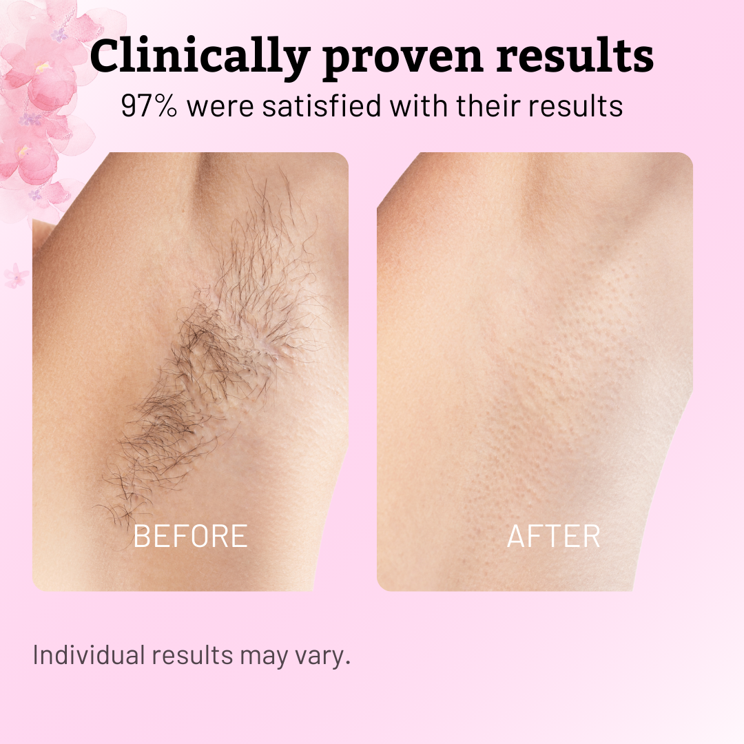 Caramela Beauty Cyperus Rotundus Oil for Natural Permanent Hair Reduction-Shop