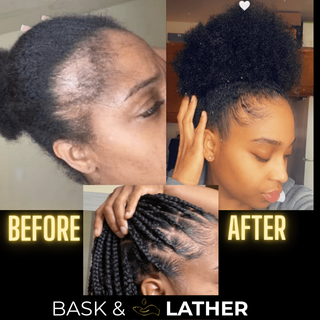 Scalp Stimulator | Hair Growth Oil-Shop