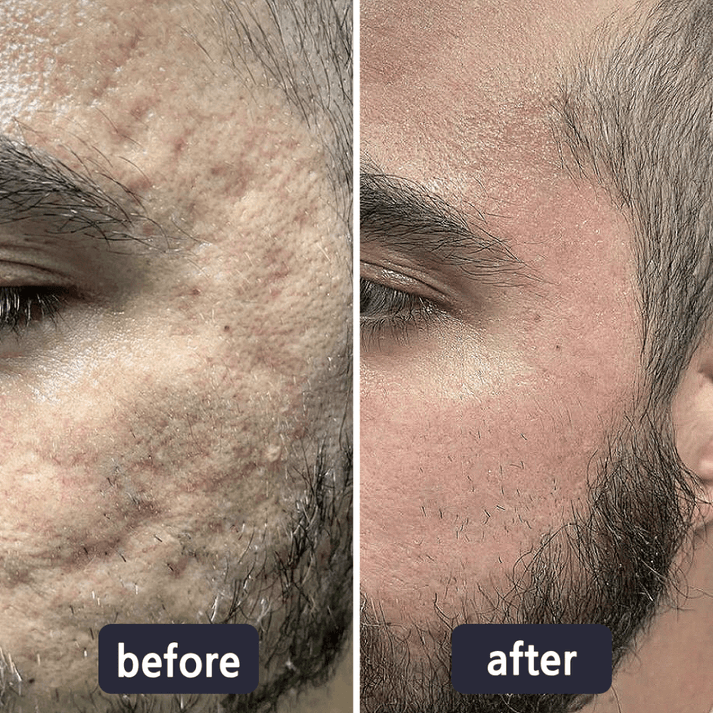 Quickly Fade New and Old Scars & Tighten Skin Repair Cream | Safe, Gentle & Suitable for Sensitive Skin
