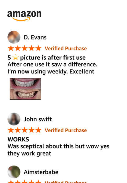 V34 Whitening Strips
