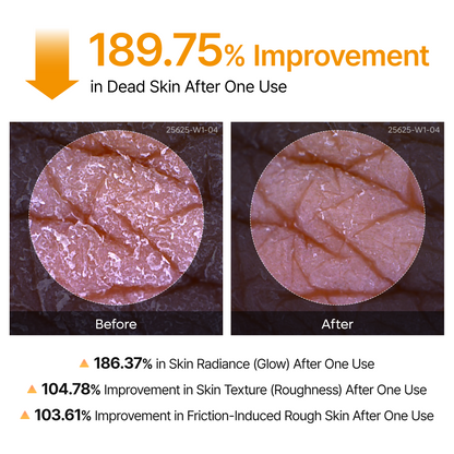 Peel Shot Keratin Care Kojic Acid Turmeric Spray-Shop