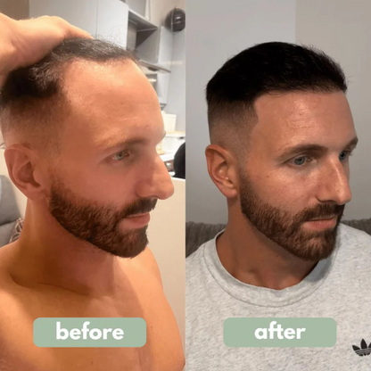 Advanced Hair Growth Roll on