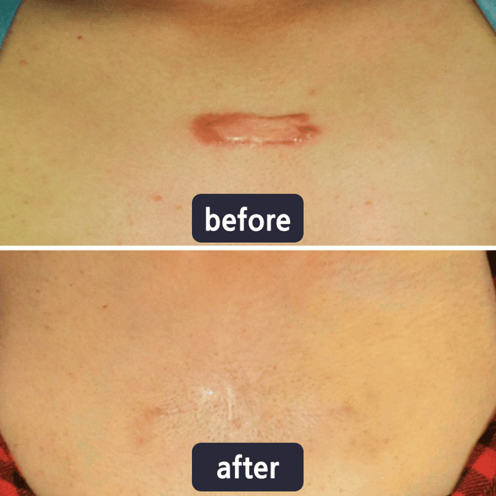 Quickly Fade New and Old Scars & Tighten Skin Repair Cream | Safe, Gentle & Suitable for Sensitive Skin