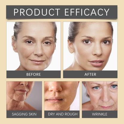 🐝💎 Botox Bee Venom Wrinkle Removal Cream 💎🐝-Shop
