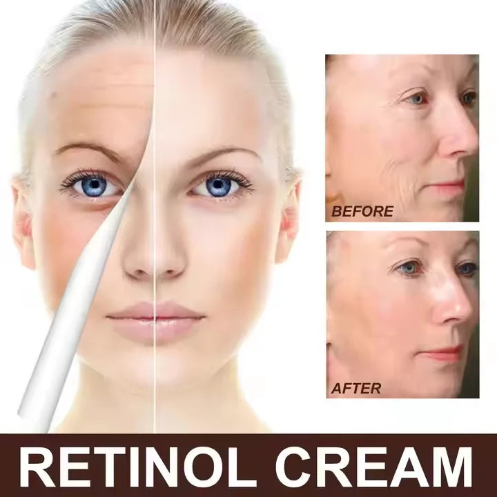 🐝💎 Botox Bee Venom Wrinkle Removal Cream 💎🐝-Shop