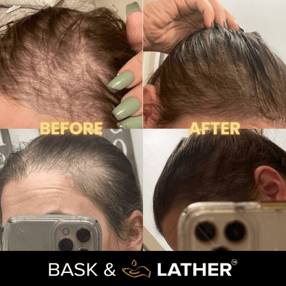 Scalp Stimulator | Hair Growth Oil-Shop